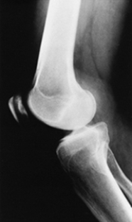 Which of the following imaging techniques illustrated in the pictures would be the most efficient to discover if there is a loose body within a joint? A) B) C) D) E)