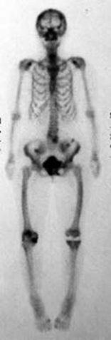 Which of the following imaging techniques illustrated in the pictures would be the most efficient to discover if there is a loose body within a joint? A) B) C) D) E)