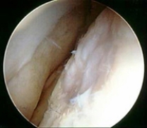 Which of the following imaging techniques illustrated in the pictures would be the most efficient to discover if there is a loose body within a joint? A) B) C) D) E)