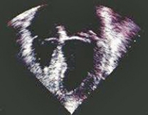 Which of the following imaging techniques illustrated in the pictures would be the most efficient to evaluate soft-tissue musculoskeletal disorders? A) B) C) D) E)