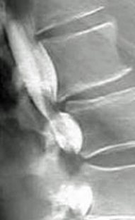 Which of the following imaging techniques illustrated in the pictures would be the most efficient to evaluate soft-tissue musculoskeletal disorders? A) B) C) D) E)