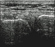 Which of the following imaging techniques illustrated in the pictures would be the most efficient to evaluate soft-tissue musculoskeletal disorders? A) B) C) D) E)