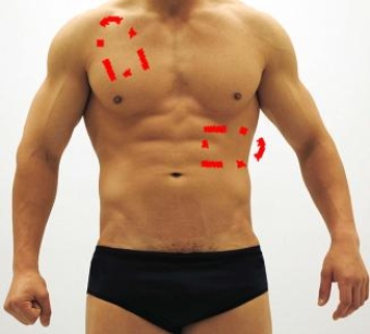 Please identify each of the correct locations on the victim's chest to place Automated External Defibrillator (AED)  pads. A)    B)    C)    D)    E)    