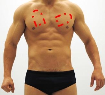 Please identify each of the correct locations on the victim's chest to place Automated External Defibrillator (AED)  pads. A)    B)    C)    D)    E)    