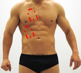 Please identify each of the correct locations on the victim's chest to place Automated External Defibrillator (AED)  pads. A)    B)    C)    D)    E)    