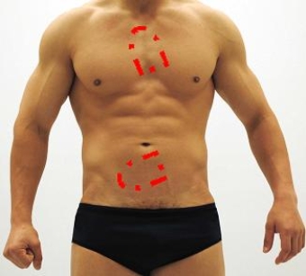 Please identify each of the correct locations on the victim's chest to place Automated External Defibrillator (AED)  pads. A)    B)    C)    D)    E)    