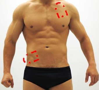 Please identify each of the correct locations on the victim's chest to place Automated External Defibrillator (AED)  pads. A)    B)    C)    D)    E)    