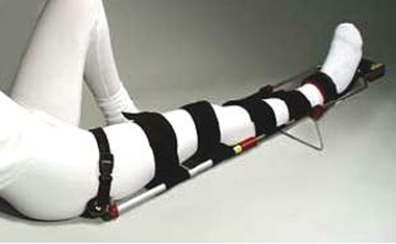 A patient has been thrown from a bull during a rodeo in which a fractured pelvis is suspected. Which of the following emergency splinting techniques would be the most appropriate? A)    B)    C)    D)    E)   