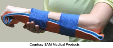 A patient is suffering from a fracture and dislocation of the ankle. Which of the following emergency splinting techniques would be the most appropriate? A)    B)    C)    D)    E)   