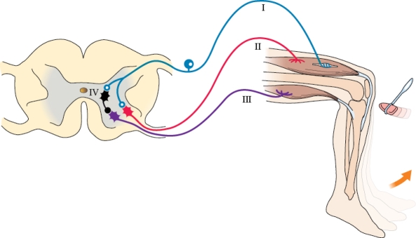 Refer to the figure shown.   Which neuron in the figure is inhibitory? A)  II B)  III C)  IV D)  All neurons are excitatory.