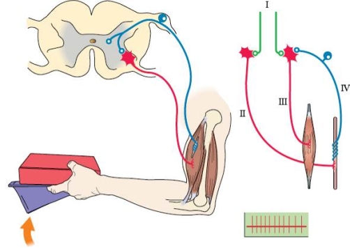 Refer to the figure shown.   Of the four numerals in the figure, which one best represents a reflex pathway? A)  I B)  II C)  III D)  IV