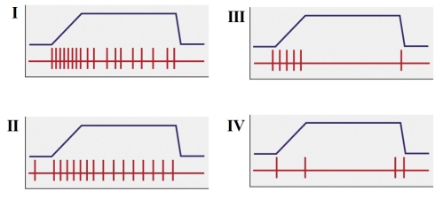 Refer to the figure shown.   Which panel(s) would be categorized as a phasic receptor? A) I B) IV C) I and II D) III and IV