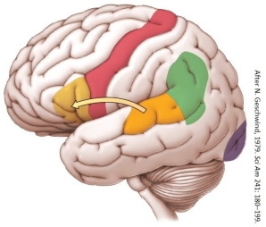 Refer to the figure.   Which statement about the arrow in the figure is most accurate? A)  The arcuate fasciculus is a bundle of axons between Wernicke's area and the precentral gyrus. B)  Electrical impulses from Wernicke's area jump over regions of cortex to Broca's area. C)  Wernicke's area has been shown to transmit information to Broca's area via the arcuate fasciculus. D)  When speaking a word, information is transmitted from Broca's area to Wernicke's area via the arcuate fasciculus.