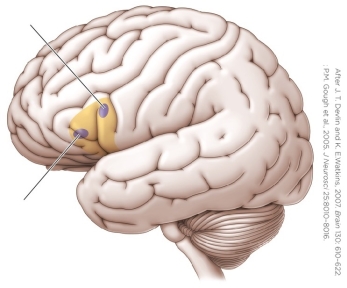 Refer to the figure.   The leaders point to two regions of Broca's area, discovered by _______ to affect _______. A)  Wilder Penfield; speech production and speech processing B)  PET; only phonological processing C)  DTI; only semantic processing D)  TMS; phonological and semantic processing