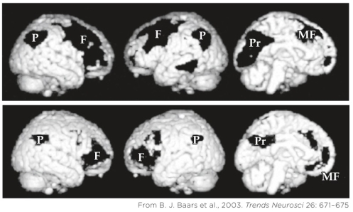 Refer to the figure.   What do the similarities between the scans in the figure indicate? A)  These scans show the areas of the cortex that are active while subjects who are in a coma (top)  and subjects who are alert (bottom)  are answering  yes  and  no  to a researcher's questions. B)  These scans demonstrate that neural activity in particular regions is greater in an alert subject (bottom)  than in a coma patient (top) . C)  The scans show locations of increased activity in alert subjects (bottom)  compared to sleeping subjects (top) . D)  The scans illustrate the similar pattern of reduced activity in the brains of individuals in a coma (top)  and those who are sleeping (bottom) .