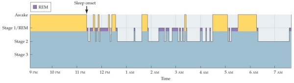 Refer to the figure showing the sleep pattern of a patient with depression.   Patients with depression do not exhibit A)  rapid onset of REM sleep. B)  increased amounts of REM in the first half of sleep. C)  difficulty falling asleep. D)  excessive amounts of stages 3 sleep.