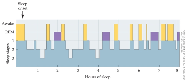 Refer to the figure, showing the typical sleep pattern of an elderly person.   This pattern shown here is notable because of the A)  relatively long duration of REM sleep. B)  short duration of the awakenings. C)  eight-hour duration. D)  greatly reduced stage-3 sleep.