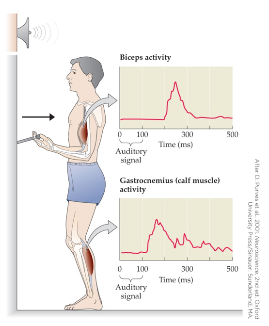 Refer to the figure.   The experiment in the figure demonstrated that A)  our behavior is the sum of reflexive responses to our environment. B)  impulses travel faster through the motor neurons that innervate our calf muscles. C)  a motor plan to stabilize our body precedes the pull of a lever. D)  the reflex for pulling a lever is slower than the reflex for stabilizing the body.