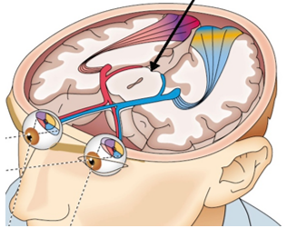 Refer to the figure.   If a person sustained damage to the region indicated by the arrow in the figure, A)  light information from the individual's retina would no longer reach their visual cortex. B)  the individual would no longer be able to orient their gaze to see an object. C)  the individual would be blind. D)  the individual would only be able to see shadows and shades of light and dark.