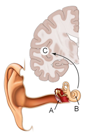 Refer to the figure.   Damage at area B in the figure could cause which kind of deafness? A)  Cortical deafness B)  Conduction deafness C)  Word deafness D)  Sensorineural deafness