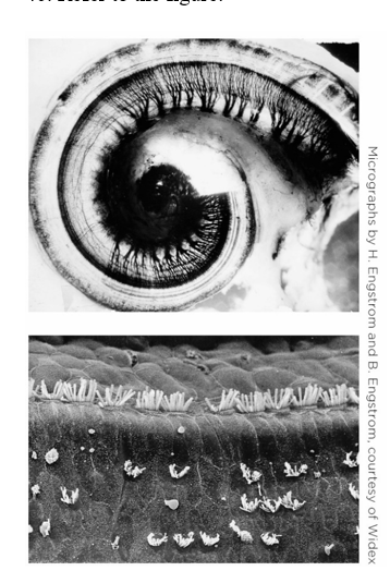 Refer to the figure.   This damage shown in these images might result in A)  conduction deafness. B)  sensorineural deafness. C)  central deafness. D)  word deafness.