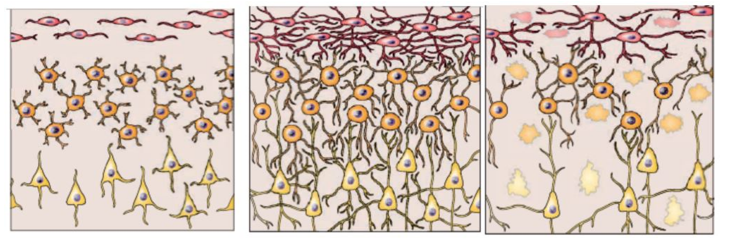 Refer to the figure, which shows several stages in nervous system development.   Which process is occurring in the middle frame of the figure? A)  Cell differentiation B)  Cell death C)  Synapse rearrangement D)  Synaptogenesis