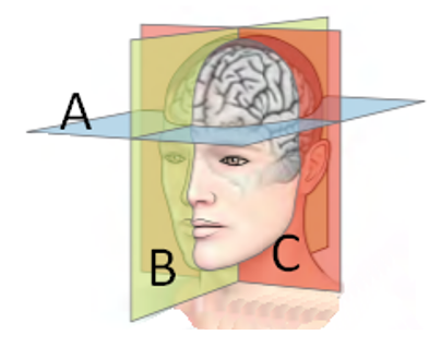 Refer to the figure.   The plane labeled A is called the _______ plane, the plane labeled B is the _______, and the plane marked C is the _______. A)  dorsal; sagittal; posterior B)  sagittal; ipsilateral; coronal C)  horizontal; sagittal; coronal D)  coronal; horizontal; sagittal