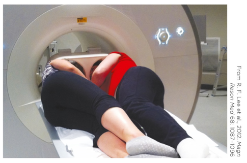Refer to the photo.   The procedure depicted here is most likely A)  transcranial magnetic stimulation. B)  DTI tractography. C)  dyadic functional MRI. D)  angiography.