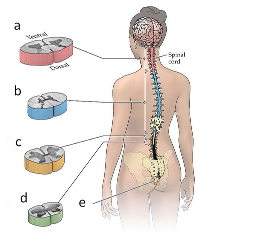 Refer to the figure.    Match each of the letters to proper term for the segment of the spinal cord to which it is pointing. -_____ 1. Lumbar 2. Cervical 3. Coccygeal 4. Sacral 5. Thoracic