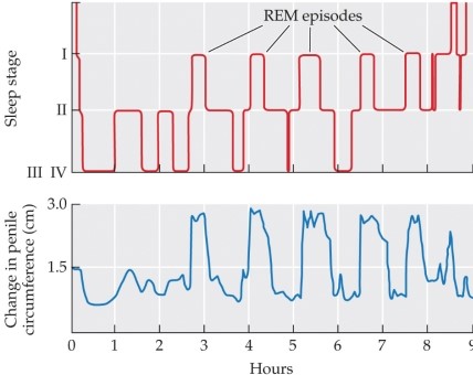 Refer to the figure.   Based on the information in the graph, the nocturnal erections of a man who is temporarily unable to experience REM sleep would A)  increase in number. B)  decrease in number. C)  decrease in number but increase in strength. D)  increase in number but decrease in strength. E)  cease until REM sleep was restored.