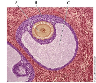 Refer to the figure.   This is a microscopic view of an ovarian follicle. The correct labels for the lettered structures are A)  A: ovum; B: supporting cells; C: cavity B)  A: cavity; B: ovary; C: ovum C)  A: ovum; B: oviduct; C: os D)  A: ovary; B: supporting cells; C: ovum E)  A: os; B: ovum; C: fimbria