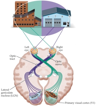 Refer to the figure.    Using the number labels in shown the visual fields of the figure, list which parts of the visual field would be affected by a lesion in right optic tract (marked in red).