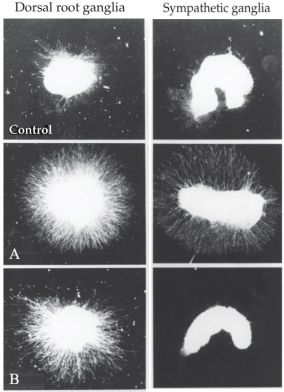 Refer to the figure.   Two neurotrophic factors (A and B) were applied to either dorsal root (left column) or sympathetic (right column) ganglia. Which neurotrophic factor is represented by A and which is represented by B, and what do you know about the effects of each factor that support your conclusion?<div style=padding-top: 35px> 