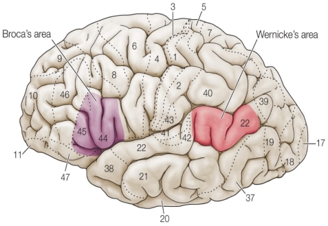 Refer to the figure. Identify Broca's and Wernicke's areas, and summarize the types of linguistic deficits that patients with lesions in each would typically experience. Provide an example of spoken language that would represent lesions in each of these two cortical regions.