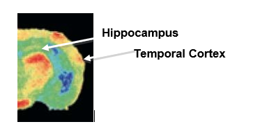   In the image above is an autoradiograph of the left hemisphere of a mouse brain after radioactive 2-DG injections taken after the mouse had just completed a memory test in an 8-arm radial maze. Would you assume this mouse had just started training or was several days into the training to remember which arm contained food? A)  just started training B)  several days into training C)  the autoradiograph can not be used to determine this D)  somewhere between the first and last days of training