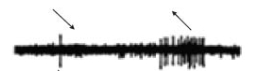 Which stimuli directionality would you expect to elicit the response of the above V1 neuron recording below?   A)    B)    C)       