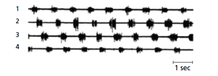   The image above showing neural activity in four electrodes placed opposite each other, 1 across from 3 and 2 across from 4, in sequence in a spinal cord. Which of the following can be derived from this data? A)  activity in electrode 1 seems to inhibit activity in electrode 3 and visa versa, indicative of the rhythmic activity of lateral undulation B)  activity in electrode 1 seems to inhibit activity in electrode 2 and visa versa, indicative of the rhythmic activity of lateral undulation C)  activity in electrode 2 seems to inhibit activity in electrode 3 and visa versa, indicative of the rhythmic activity of active swimming D)  All of these neural activity recorded is inhibitory E)  There is no pattern of activity that can be derived from reviewing this data