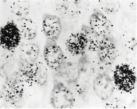 The picture below is a hippocampal section from an animal injected with tritiated thymidine shortly after birth and sacrificed two weeks later. What can you conclude from this image?   A)  no cell division has occurred during this two-week period of time B)  the rate of cell division seems to be slower than before birth C)  the presence of radioactive thymidine in the image indicates DNA synthesis has occurred D)  all of the cells in the image are neurons E)  all of the above