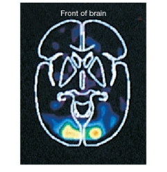 Refer to the figure below.   This mean difference image shows the most active brain areas across participants when they are completing a specific task. If lighter areas mean greater brain activity, what task were participants most likely completing? A)  Speaking B)  Listening to music C)  Touching something with a rough texture D)  Looking at an image