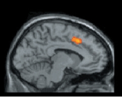 <strong>What technique most likely generated the brain image below? </strong> A) EEG B) ERP C) dMRI D) fMRI