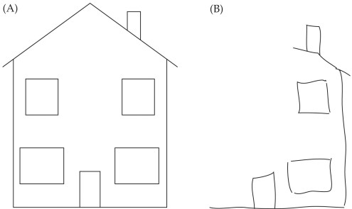 Refer to the figure.   This figure depicts what can happen when a patient with _______ tries to copy a drawing. A)  neglect B)  scotoma C)  a lesioned left temporal lobe D)  a lesioned left parietal lobe E)  a lesioned right temporal lobe