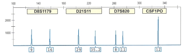 Below is a DNA STR profile of four (4) loci. a. Determine the genotype of each loci. b. Determine the base pair size of each peak. c. Assume that D8S1179 & D7S820 are the same size repeat.How can the D7S820 allele 8 be larger in terms of base pairs than D8S1179 allele 9?
