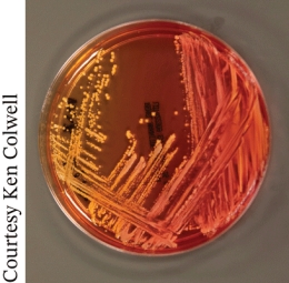 <strong>The photo shows growth of a nasal specimen overnight on Mannitol salt agar. This result shows the pathogen is most likely  </strong> A) Staphylococcus aureus B) MRSA C) Closteroides difficile D) Pseudomonas aeruginosa <div style=padding-top: 35px> 
