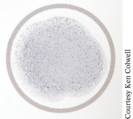 <strong>The photo of a coagulase agglutination test is ____________________ and is used to confirm diagnosis of ________________________.  </strong> A) negative; Staphylococcus aureus B) positive; Staphylococcus aureus C) negative; Staphylococcus epidermidis D) positive; Staphylococcus epidermidis <div style=padding-top: 35px> 
