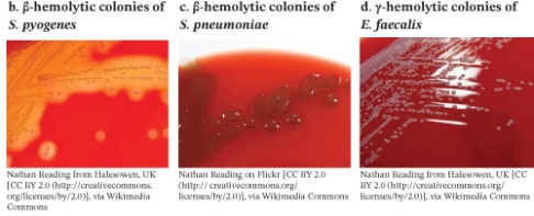 A pathogen that has the growth pattern shown in the photo when grown on blood agar is   A)  Streptococcus pyogenes B)  Streptococcus pneumoniae C)  Enterococcus faecalis D)  Staphylococcus epidermidis