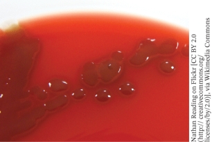 A pathogen that has the growth pattern shown in the photo when grown on blood agar is   A)  Streptococcus pyogenes B)  Streptococcus pneumoniae C)  Enterococcus faecalis D)  Staphylococcus aureus