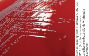 A pathogen that has the growth pattern shown in the photo when grown on blood agar is   A)  Streptococcus pyogenes B)  Streptococcus pneumoniae C)  Enterococcus faecalis D)  Staphylococcus aureus