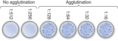 Determine the titer for the results of the agglutination assay shown below.   A)  1:512 B)  1:128v C)  521 D)  128