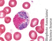 <strong>Identify this white blood cell. </strong> A) basophil B) eosinophil C) lymphocyte D) monocyte