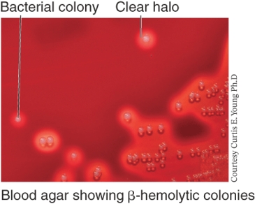 An example of a bacterial species that shows the growth pattern seen below is ________.   A)  Streptococcus pyogenes B)  Streptococcus pneumoniae C)  E. coli D)  Salmonella